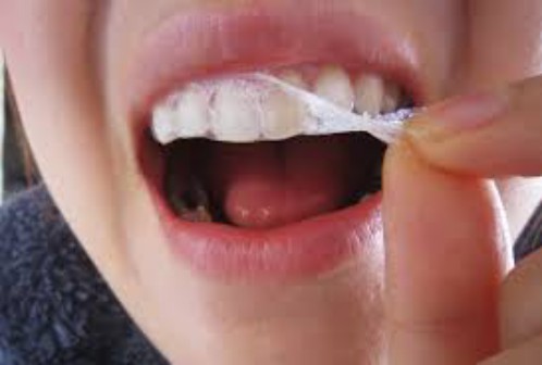 Các phương pháp tẩy trắng răng tại nhà 2