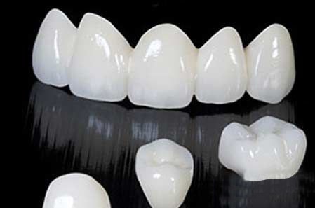Cấu tạo răng sứ cercon 3