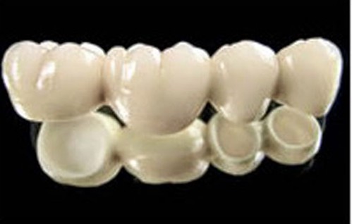 Cấu tạo răng sứ cercon 4