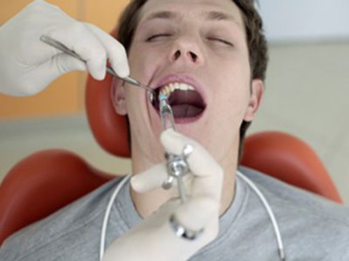 Nhổ răng khi chỉnh nha