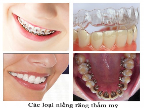 Răng vẩu 3