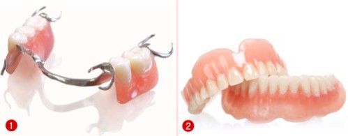 Các kiểu làm răng giả nguyên hàm 3