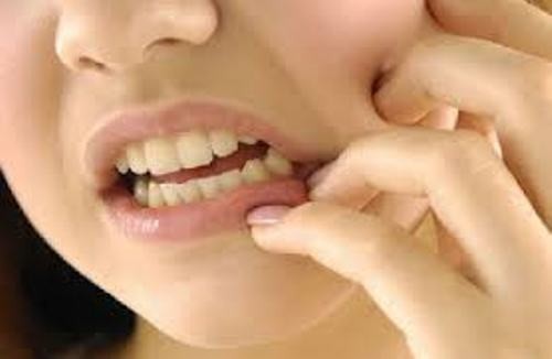 Phương pháp phục hình cầu răng 2