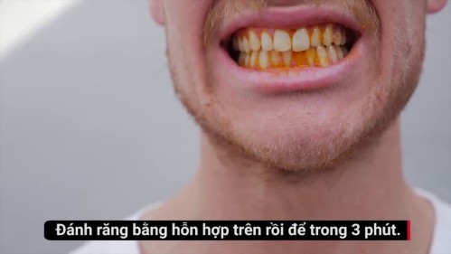8 cách làm trắng răng tự nhiên cho nụ cười sáng 6