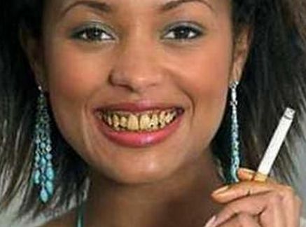 Các nguyên nhân khiến răng bị ố vàng