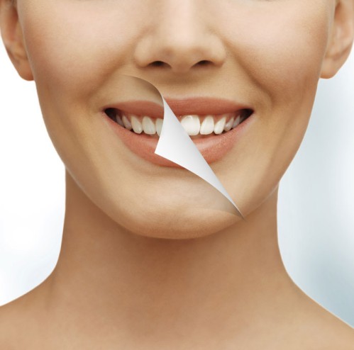 8 cách làm trắng răng tự nhiên cho nụ cười sáng 1