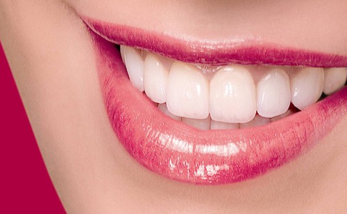 Thay đổi răng xấu nhờ công nghệ làm răng sứ mới 1