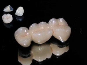 Phục hình thẩm mỹ bằng răng sứ