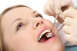 Nhổ răng hạn chế chấn thương trong chỉnh nha