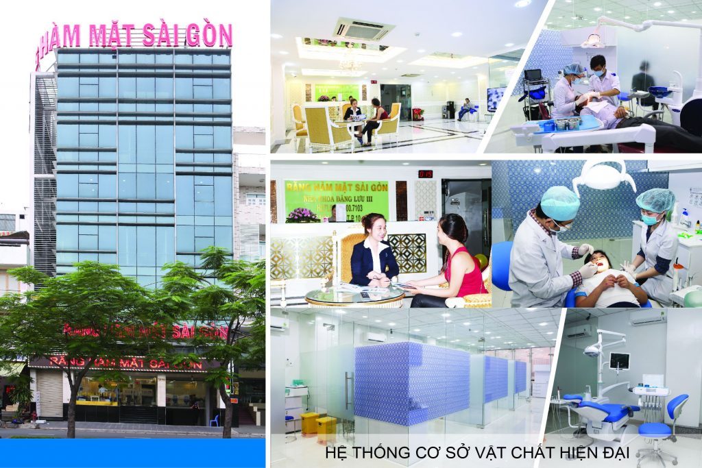 Phương pháp niềng răng mặt trong 3