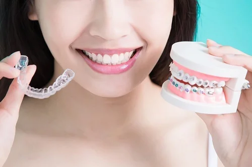 Niềng răng có làm răng yếu đi không? 2