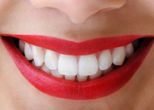 5 lợi ích khi tẩy trắng răng tự nhiên 1