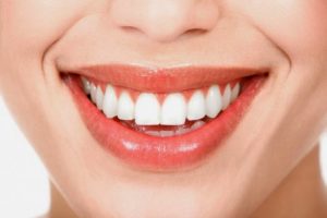 Cạo vôi răng có tác dụng gì - Nha khoa tư vấn