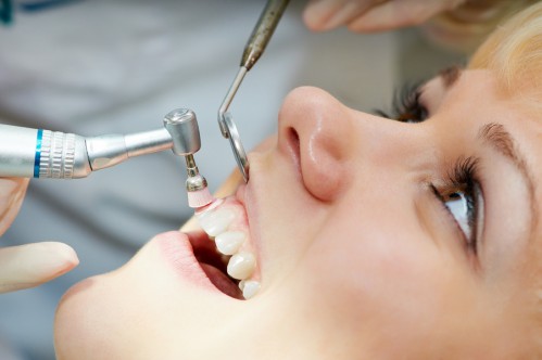 Cạo vôi răng mất bao lâu thời gian là hoàn thành? 3