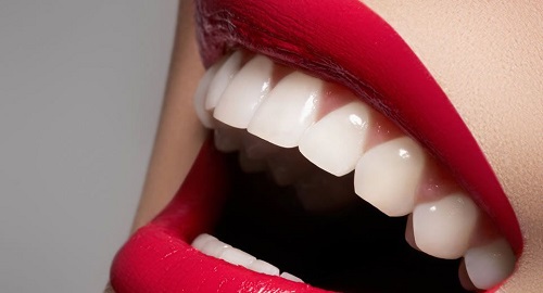 Nguyên nhân cần bọc răng sứ cho răng hàm 3