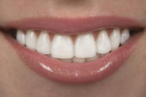 Trồng răng sứ giá bao nhiêu tiền năm 2018? 3