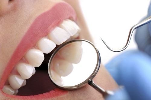 Bọc răng sứ có đau không? Thông tin về bọc răng bạn cần biết 3