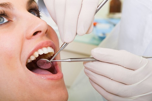 Bọc răng sứ có tác hại gì không? Những thông tin cần biết 3