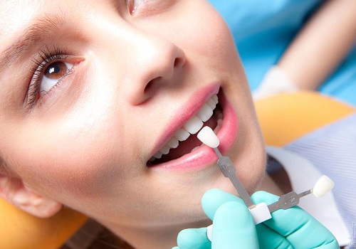 Bọc răng sứ như thế nào? Quy trình bọc răng sứ cho bạn 4