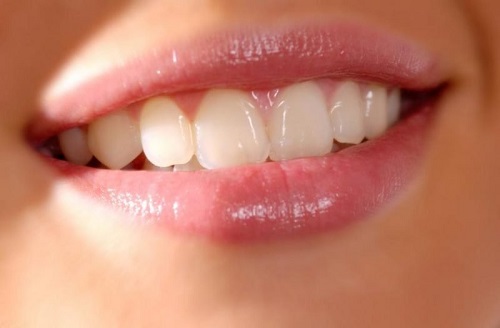 Bọc răng sứ ở đâu tốt nhất tphcm? Thông tin tìm hiểu 4