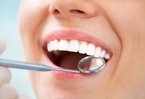 Bọc răng sứ titan có những ưu điểm gì vượt trội 2