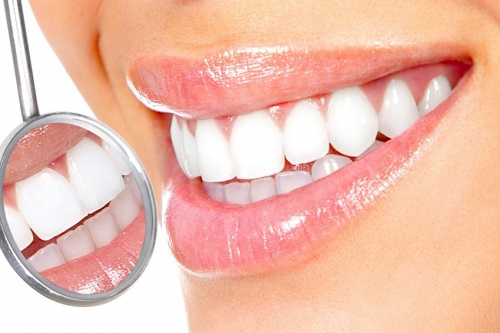 Bọc răng sứ titan có những ưu điểm gì vượt trội 4
