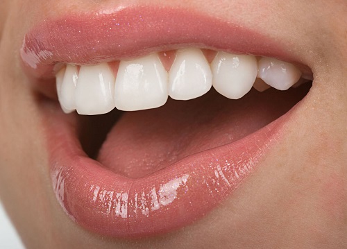 Làm răng sứ titan có tốt không? Ưu và nhược điểm răng sứ titan 2