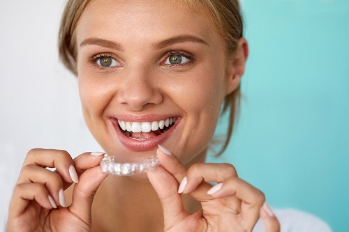 Tất cả dịch vụ niềng răng có phải nhổ răng không? 4