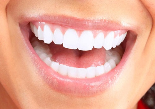 Tẩy trắng răng có đau không? Cần tìm hiểu thông tin gì trước khi tẩy trắng 2