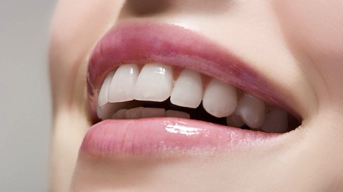 Tẩy trắng răng có đau không? Cần tìm hiểu thông tin gì trước khi tẩy trắng 3