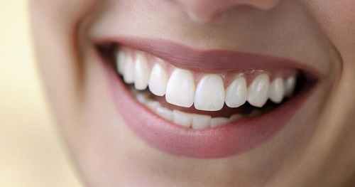 Chuyên gia giải đáp - Bọc răng sứ có ảnh hưởng gì không? 4