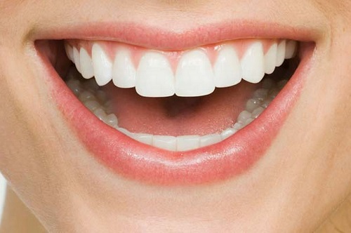 Bọc răng sứ có bền không? Độ đẹp tự nhiên là bao nhiêu phần trăm 1