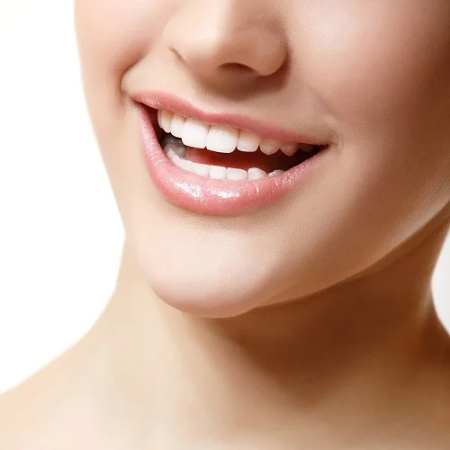 Bọc răng sứ kim loại thường nên lưu ý điều gì? 3