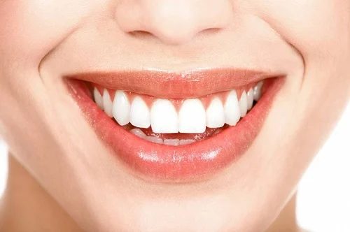 Bọc răng sứ kim loại thường nên lưu ý điều gì? 4