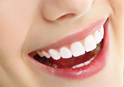 Bọc răng sứ nguyên hàm giá bao nhiêu? Có dựa vào loại dịch vụ không? 3