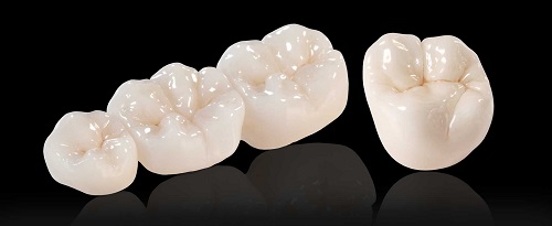 Ưu điểm bọc răng sứ zirconia bạn cần biết 1