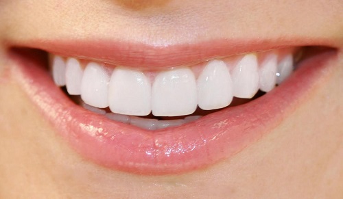 Chụp răng sứ giá bao nhiêu đảm bảo chất lượng cho khách hàng 2
