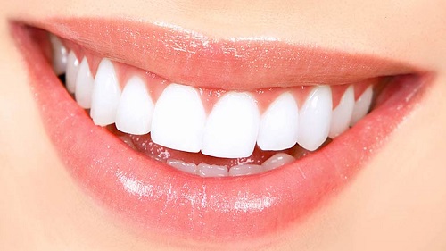 Chụp răng sứ giá bao nhiêu đảm bảo chất lượng cho khách hàng 3