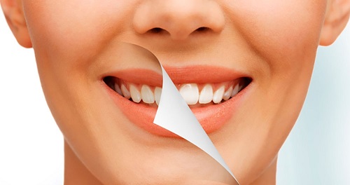 Chụp răng sứ giá bao nhiêu đảm bảo chất lượng cho khách hàng 4