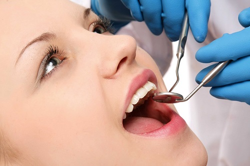 Răng bị ê buốt sau khi tẩy trắng - Hiện tượng này có bình thường không? 2