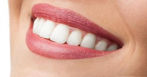 Răng sứ cercon giá bao nhiêu tiền cho 1 chiếc răng 3