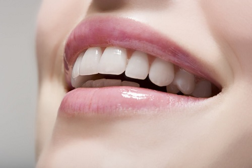 Tẩy trắng răng vĩnh viễn có được không? Chuyên gia tư vấn 1