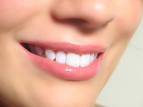 Tẩy trắng răng vĩnh viễn có được không? Chuyên gia tư vấn 2