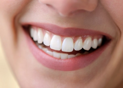 Tẩy trắng răng vĩnh viễn có được không? Chuyên gia tư vấn 3