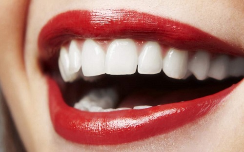 Bọc răng sứ cercon có tốt không? Dựa vào tiêu chí nào để biết 3