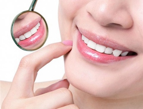 Bọc răng sứ cho răng cửa mọc lệch có giúp răng đều đặn không? 4