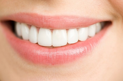 Bọc răng sứ có được vĩnh viễn không? Cần tư vấn 3