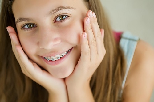 Những điều cần biết khi niềng răng bị lòi chân răng 3