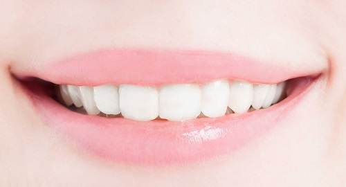 Tẩy trắng răng cho răng sâu có được không? Cần tư vấn gấp 2