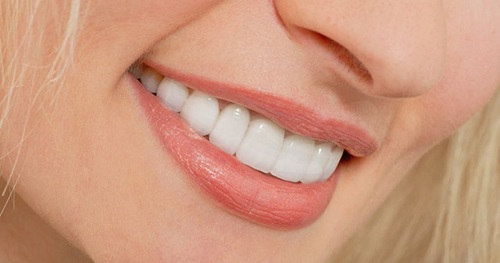 Cách tẩy trắng răng sau khi sinh an toàn hiệu quả  1